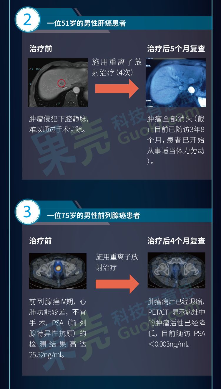 掌握前沿科技，癌症治疗最新方法助你抗癌更有信心！